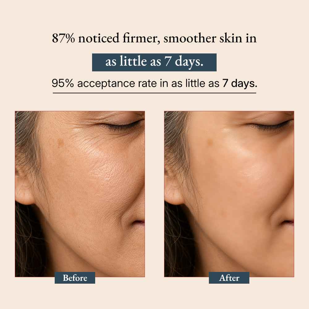 Supercharge Bakuchiol Retinol Serum | Green-Beauty Co | AI-Verified Cl