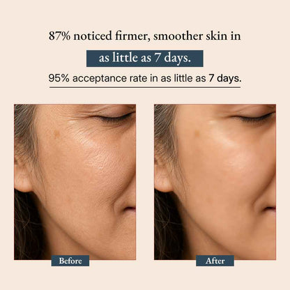 Supercharge Bakuchiol Retinol Serum | Green-Beauty Co | AI-Verified Cl