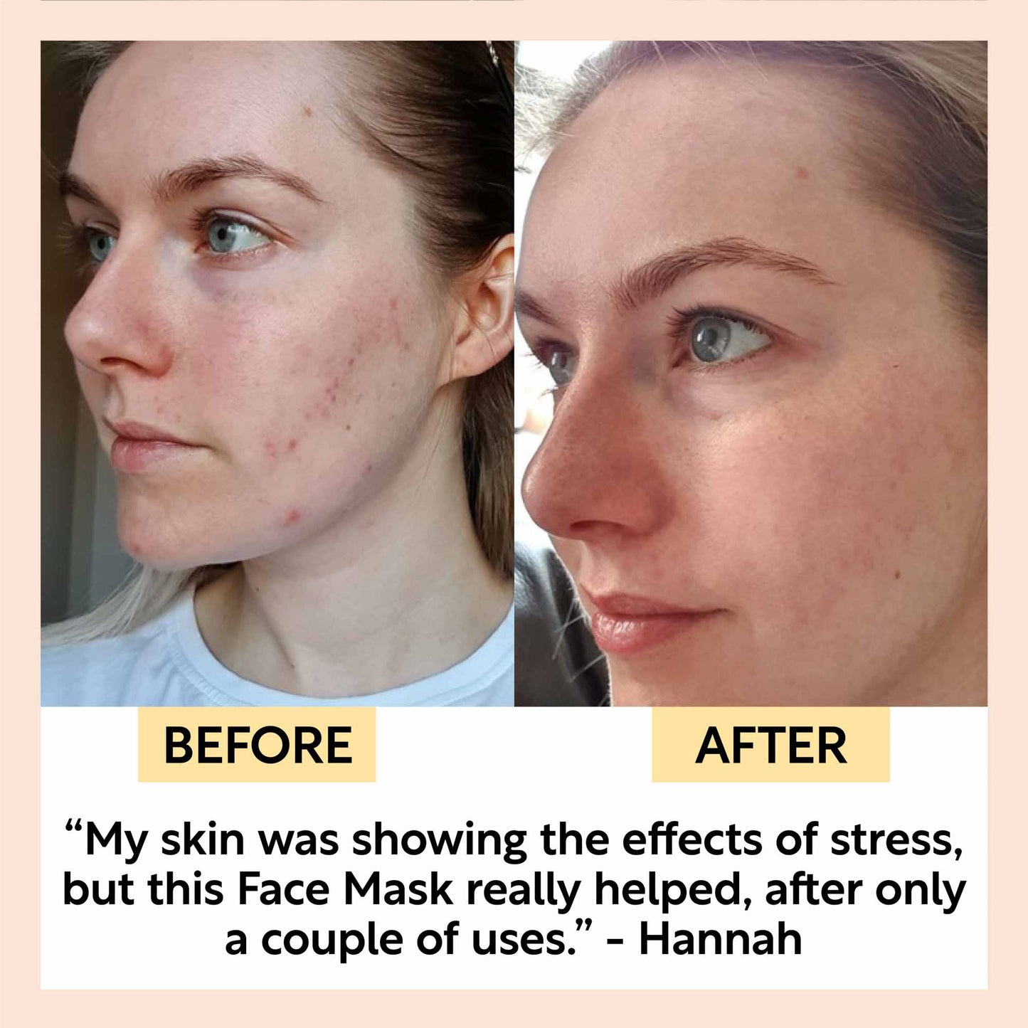 Kaolin Clay Face Mask | UpCircle | Triple Verified Clean | Daily Ritual Lab