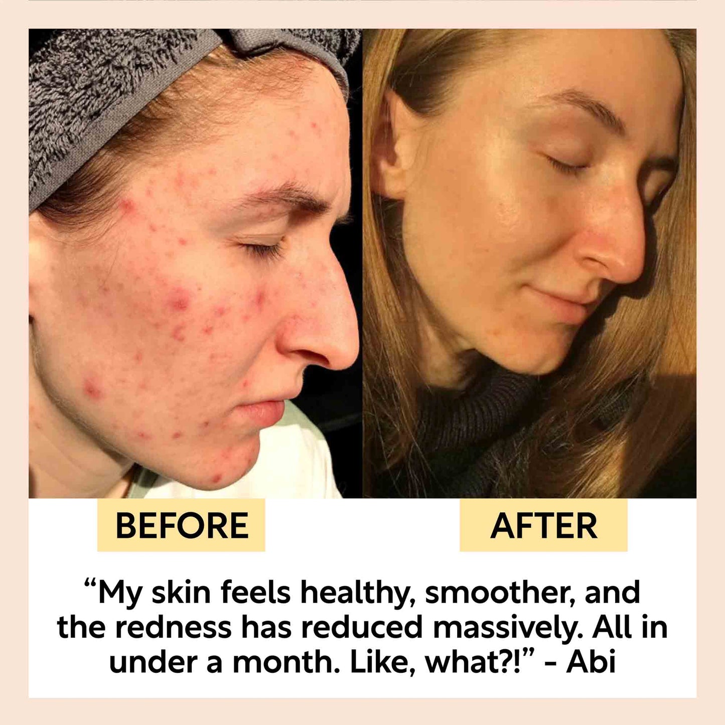 Kaolin Clay Face Mask | UpCircle | Triple Verified Clean | Daily Ritual Lab