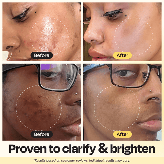 Vitamin C Clay Mask | Gleamin | Not DRL Verified | Daily Ritual Lab