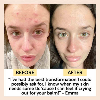 Cleansing Face Balm with Oat Oil + Vitamin E - Travel Size | UpCircle