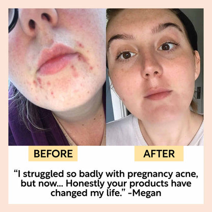 Face Moisturizer with Vitamin E - Travel Size | UpCircle | Triple Veri