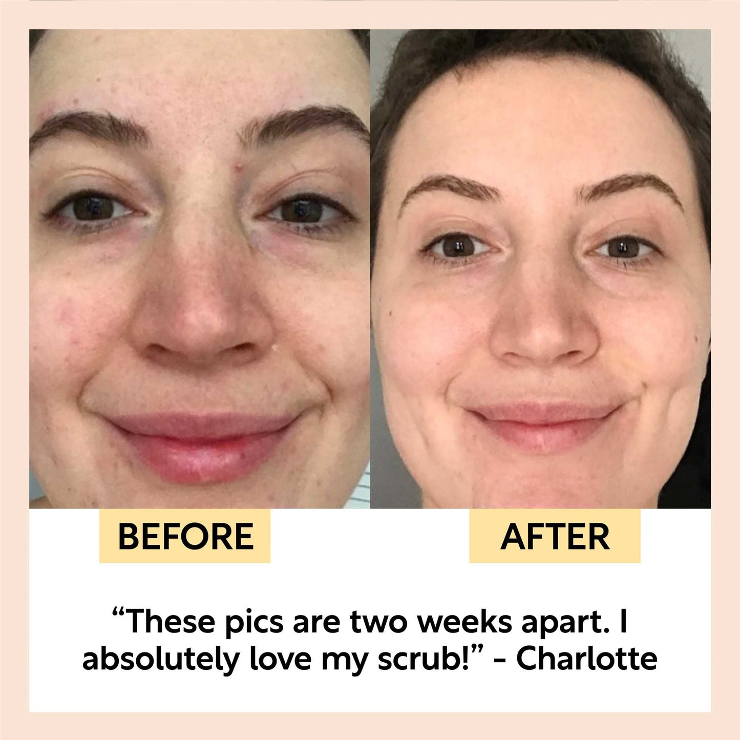 Face Scrub with Coffee + Rosehip Oil | UpCircle | Triple Verified Clea