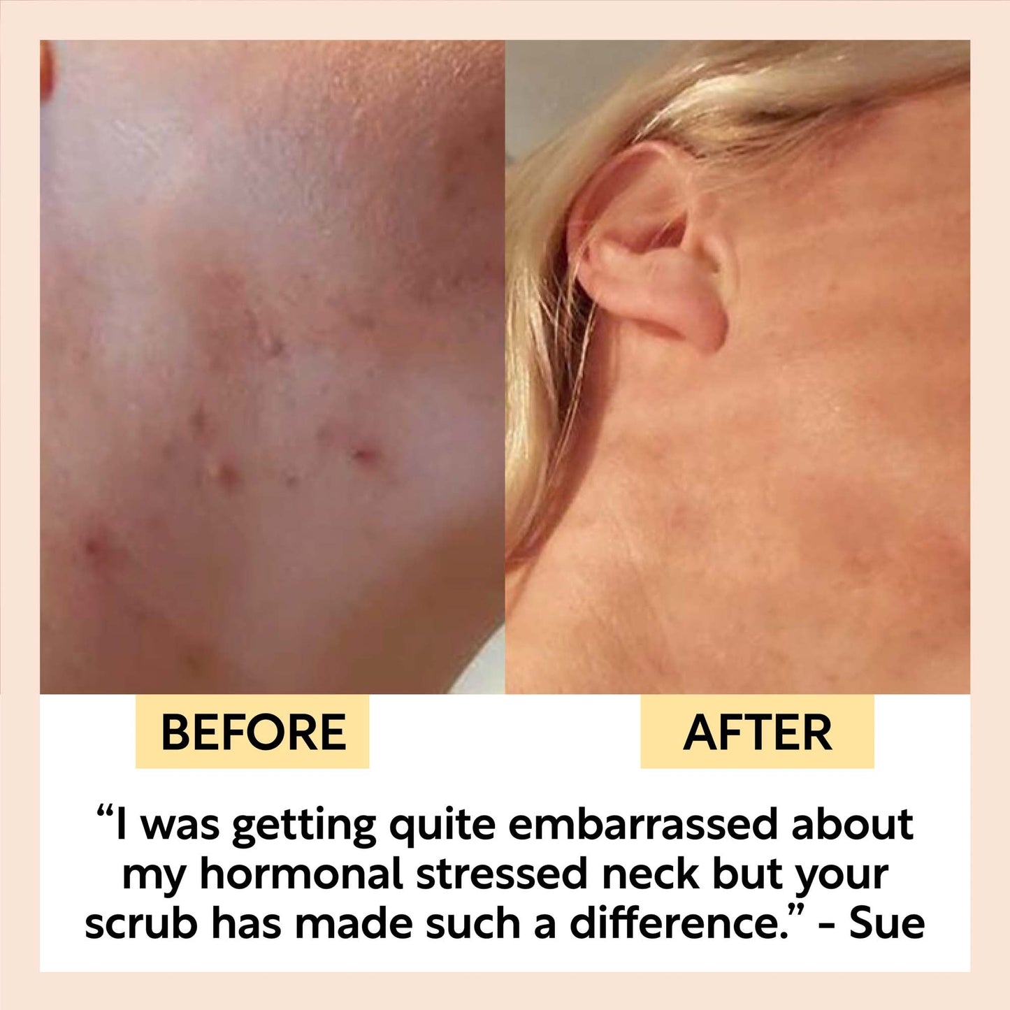 Face Scrub with Coffee + Rosehip Oil | UpCircle | Triple Verified Clea