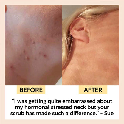 Face Scrub with Coffee + Rosehip Oil | UpCircle | Triple Verified Clea