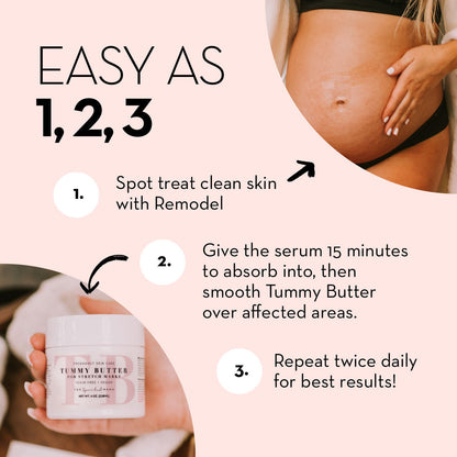 ReModel Serum: Say Goodbye to Stretch Marks