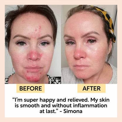 Night Cream with Hyaluronic Acid + Niacinamide | UpCircle | Triple Ver