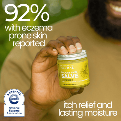 Touchy Skin Salve, Eczema Cream Ointment | Ora's Amazing Herbal | Doub
