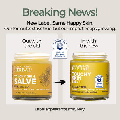 Touchy Skin Salve, Eczema Cream Ointment | Ora's Amazing Herbal | Doub